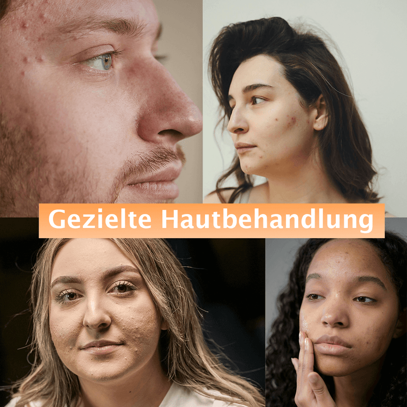 VOTAYO Smile - LED Maske für eine strahlende Gesichtshaut